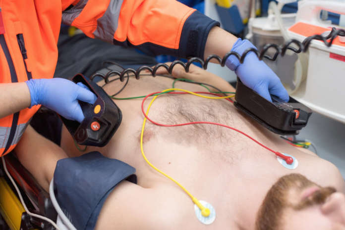 Defibrillatori: criteri e modalità per l'installazione